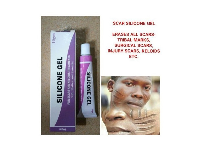 Silicone Gel Scar, Tribal Mark & Stretchmark In Abuja - 1