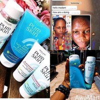 Pure skin face cream