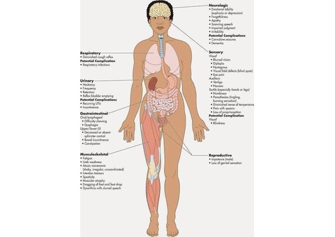 Traditional Chinese Medicine For Multiple Sclerosis (Call or WhatsApp - 08028589079)